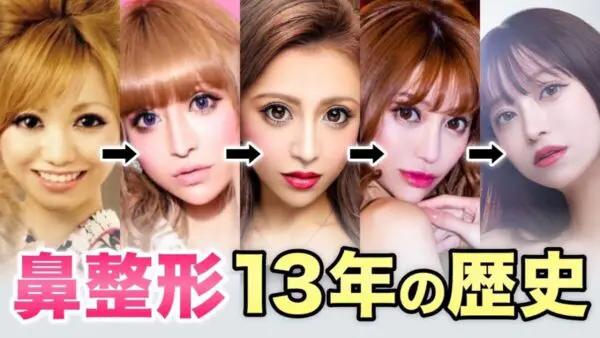 愛沢えみり、過去の鼻整形の経歴を説明！過去の写真公開にファンは「いつの時代も可愛い」と感激！